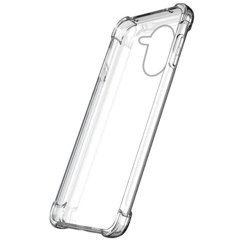 מגן xiaomi A5 4G
